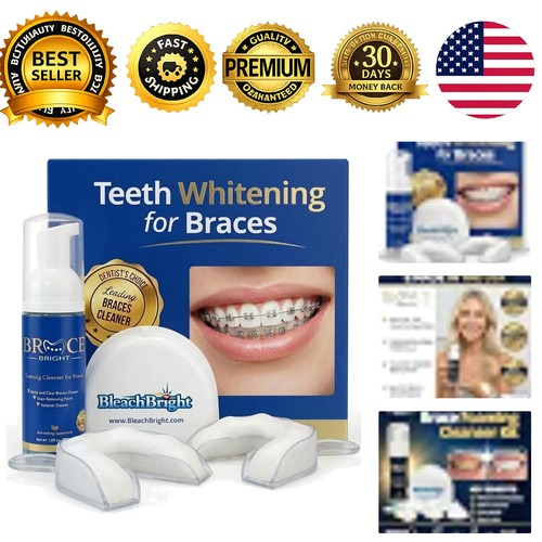 Teeth whitening for - whitening,